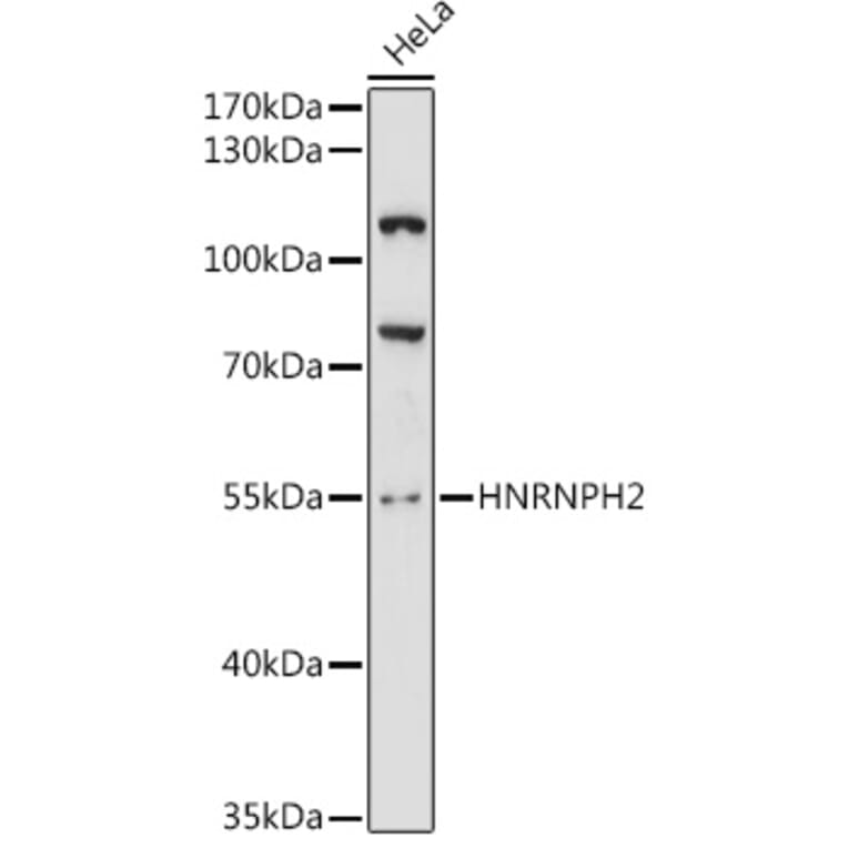 Western Blot - Anti-HNRPH2/HNRNPH2 Antibody (A90374) - Antibodies.com