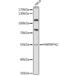 Western Blot - Anti-HNRPH2/HNRNPH2 Antibody (A90374) - Antibodies.com