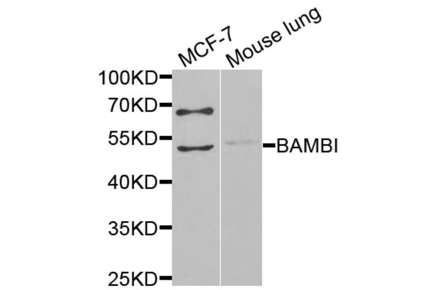 Western Blot - Anti-BAMBI Antibody (A13589) - Antibodies.com