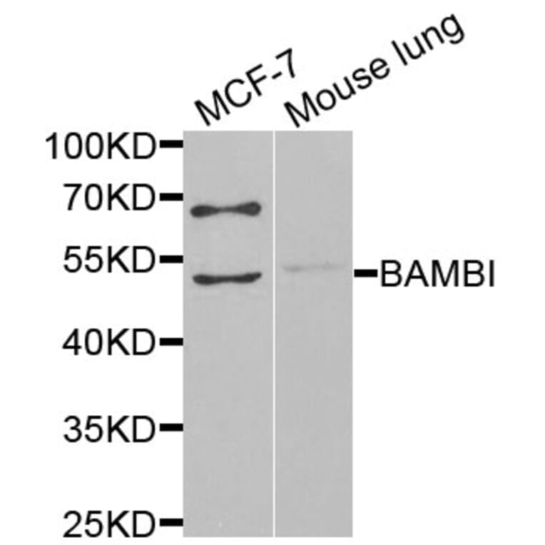 Western Blot - Anti-BAMBI Antibody (A13589) - Antibodies.com