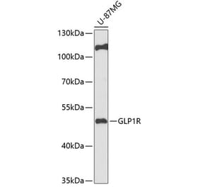 Western Blot - Anti-GLP-1R Antibody (A90376) - Antibodies.com