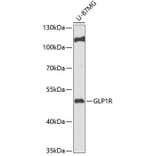 Western Blot - Anti-GLP-1R Antibody (A90376) - Antibodies.com