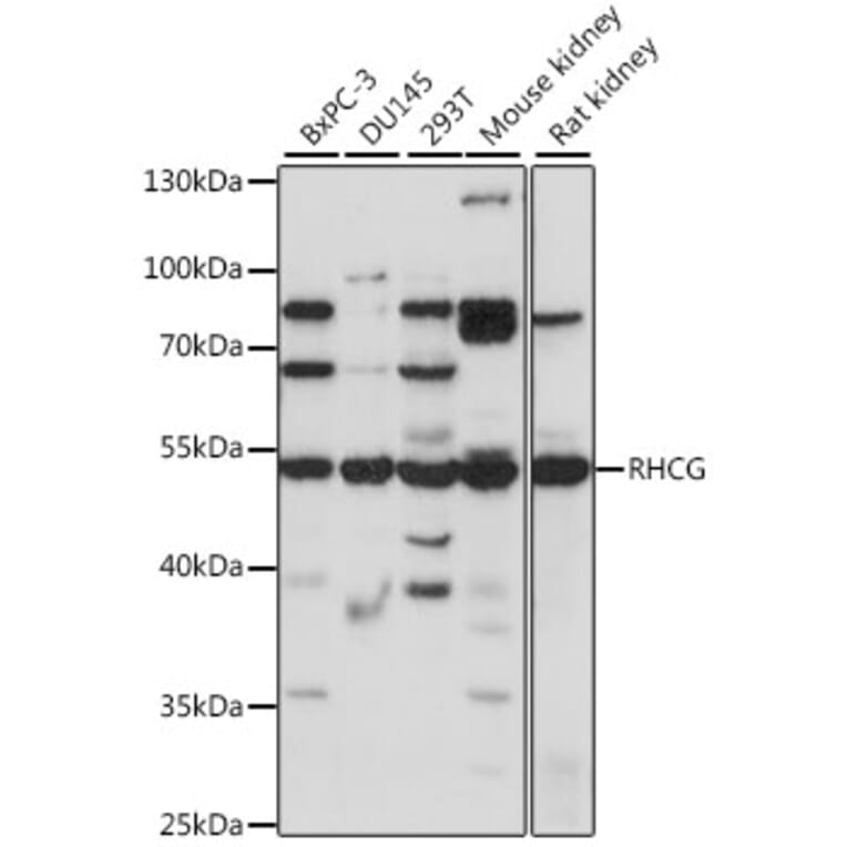 Western Blot - Anti-RHCG Antibody (A90377) - Antibodies.com