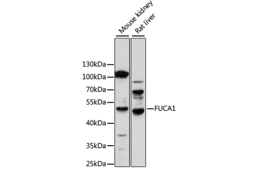 Western Blot - Anti-FUCA1 Antibody (A14533) - Antibodies.com