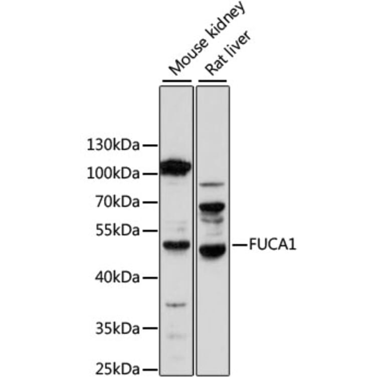 Western Blot - Anti-FUCA1 Antibody (A14533) - Antibodies.com