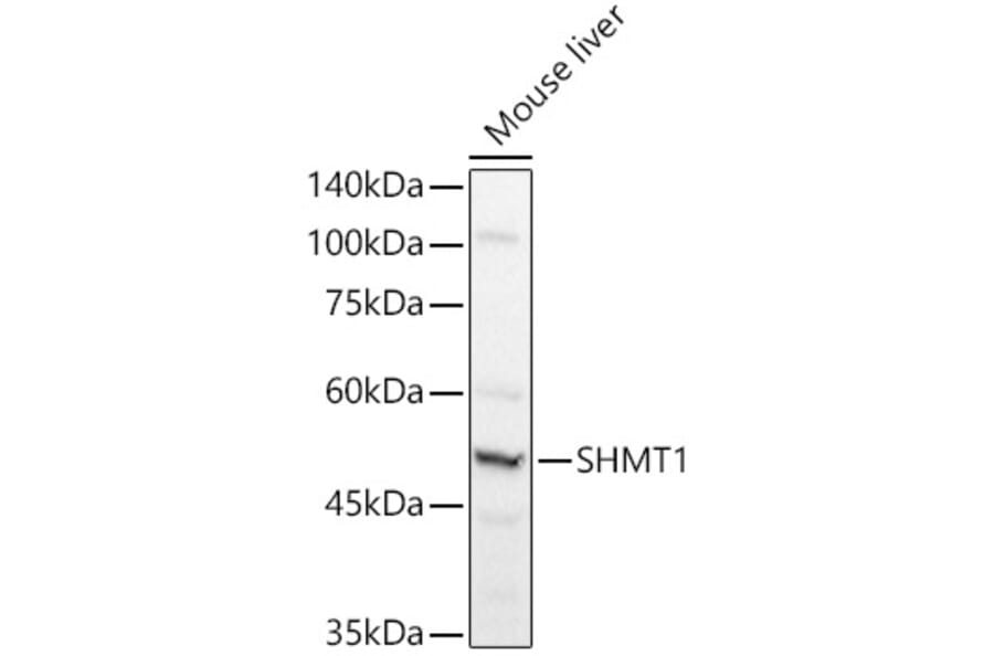 Western Blot - Anti-SHMT1 Antibody (A90379) - Antibodies.com