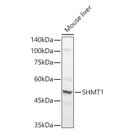 Western Blot - Anti-SHMT1 Antibody (A90379) - Antibodies.com