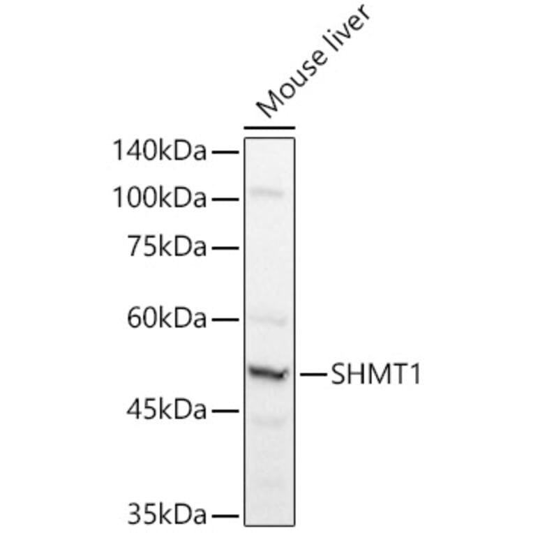 Western Blot - Anti-SHMT1 Antibody (A90379) - Antibodies.com