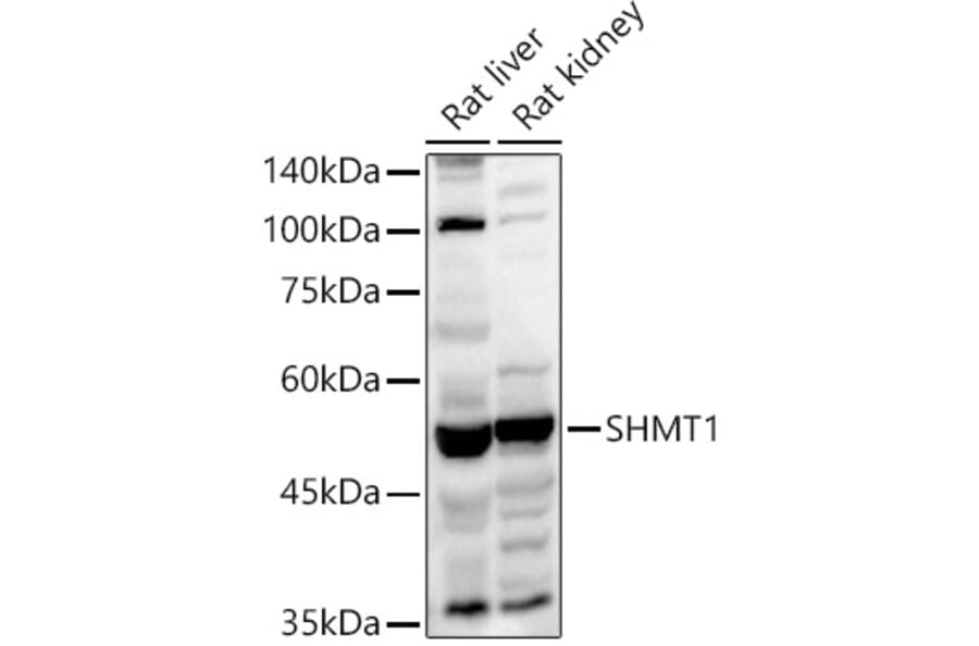 Western Blot - Anti-SHMT1 Antibody (A90379) - Antibodies.com