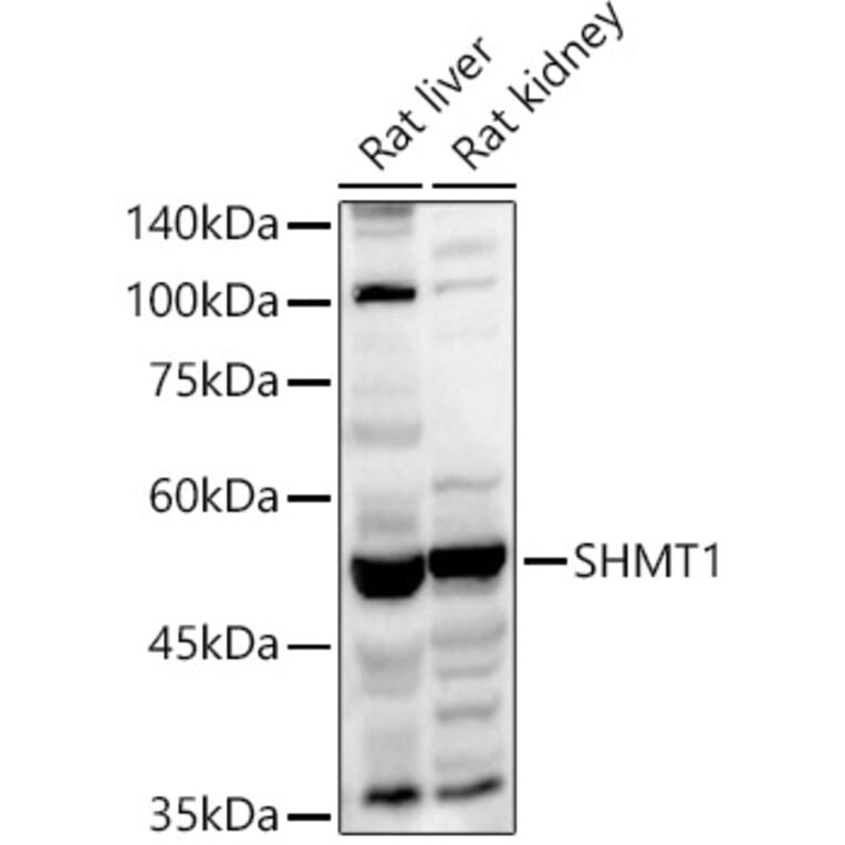 Western Blot - Anti-SHMT1 Antibody (A90379) - Antibodies.com
