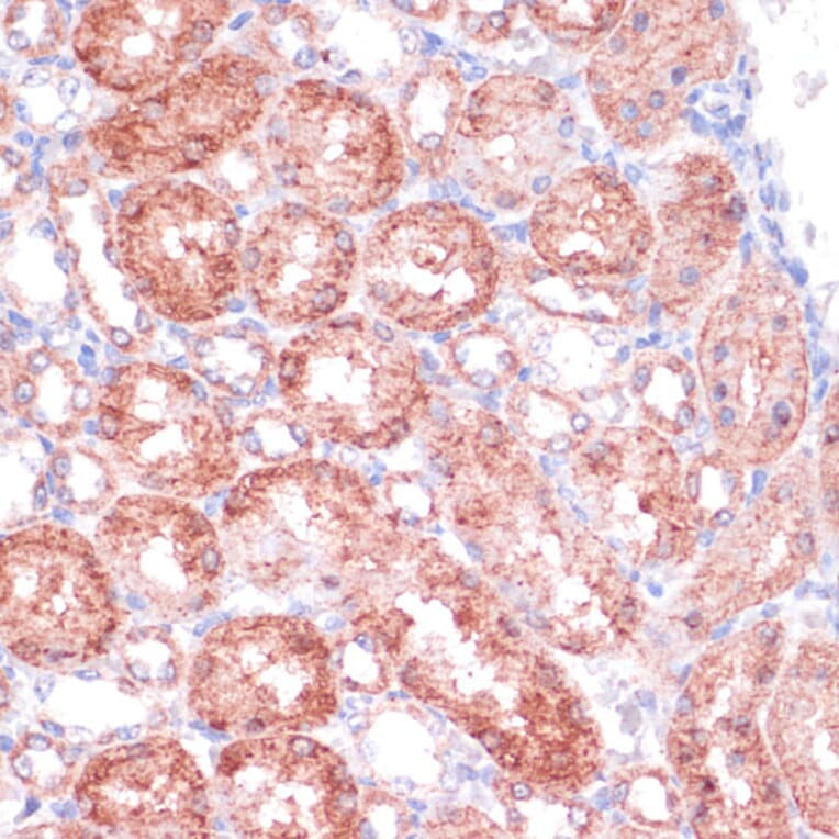 Immunohistochemistry - Anti-SHMT1 Antibody (A90379) - Antibodies.com