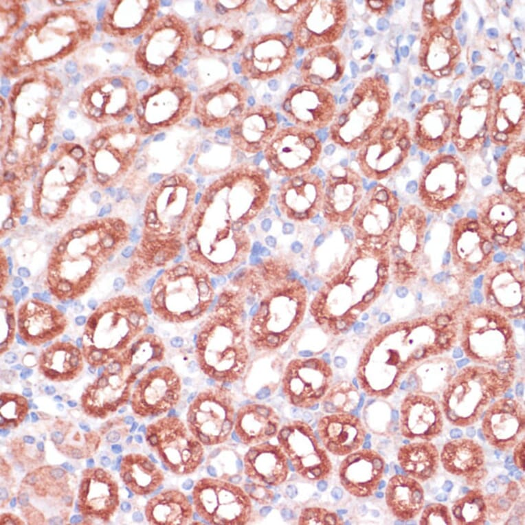 Immunohistochemistry - Anti-SHMT1 Antibody (A90379) - Antibodies.com