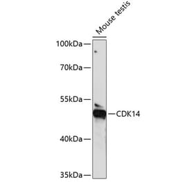 Western Blot - Anti-PFTK1 Antibody (A90380) - Antibodies.com