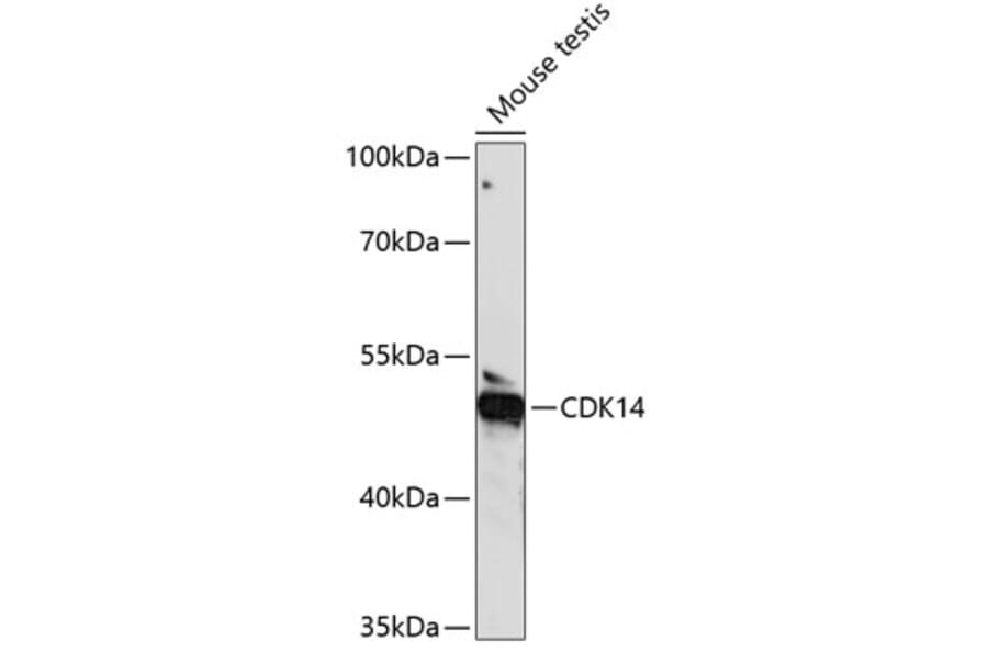 Western Blot - Anti-PFTK1 Antibody (A90380) - Antibodies.com