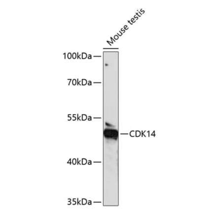 Western Blot - Anti-PFTK1 Antibody (A90380) - Antibodies.com