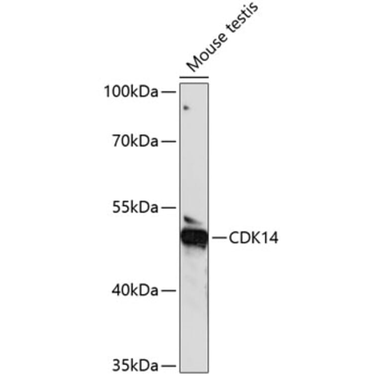 Western Blot - Anti-PFTK1 Antibody (A90380) - Antibodies.com