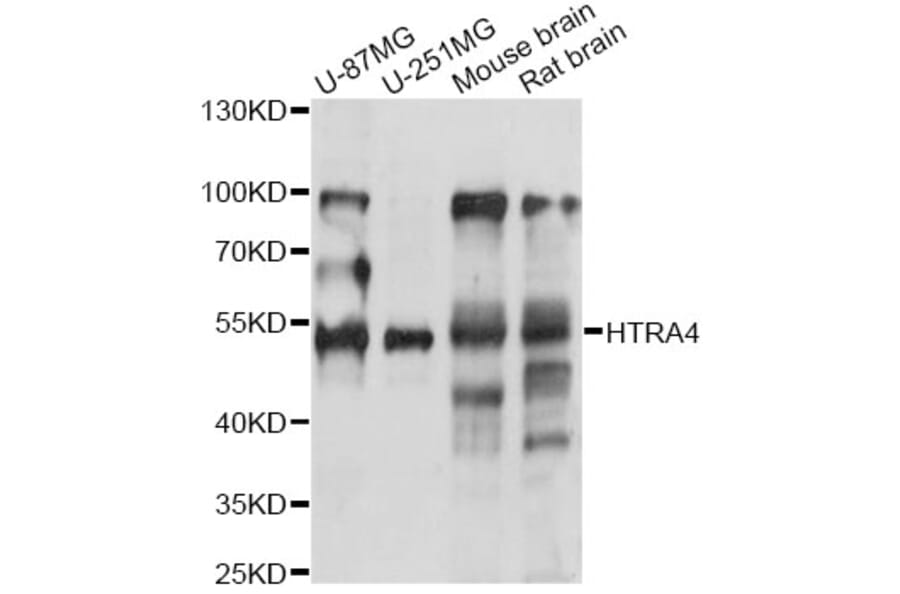 Western Blot - Anti-HTRA4 Antibody (A14314) - Antibodies.com