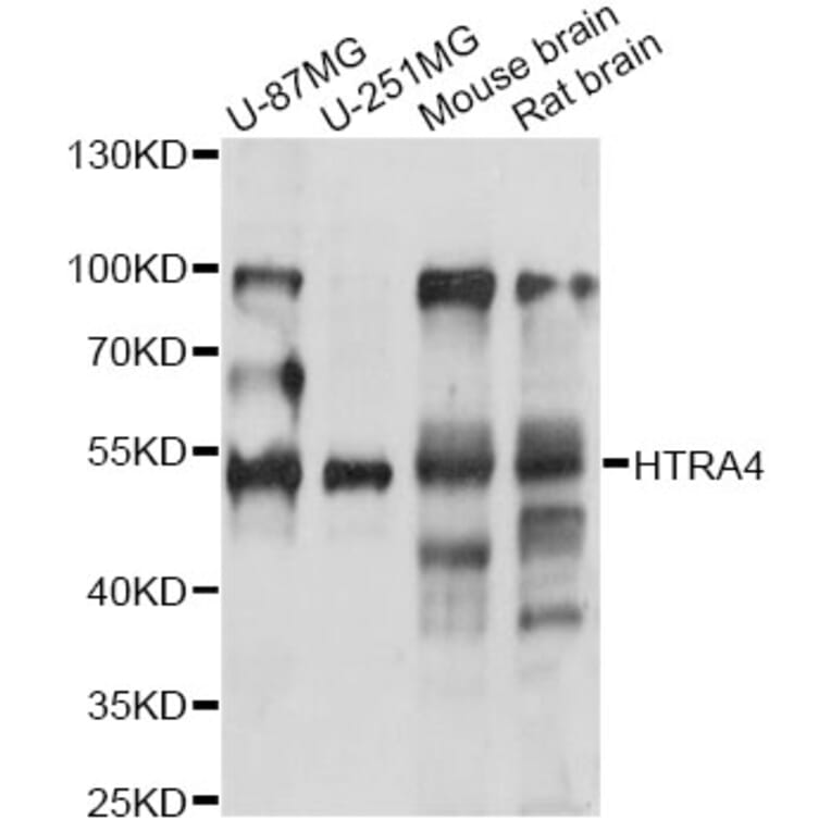 Western Blot - Anti-HTRA4 Antibody (A14314) - Antibodies.com