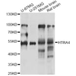 Western Blot - Anti-HTRA4 Antibody (A14314) - Antibodies.com