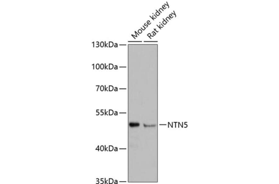 Western Blot - Anti-NTN5 Antibody (A90382) - Antibodies.com