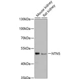 Western Blot - Anti-NTN5 Antibody (A90382) - Antibodies.com