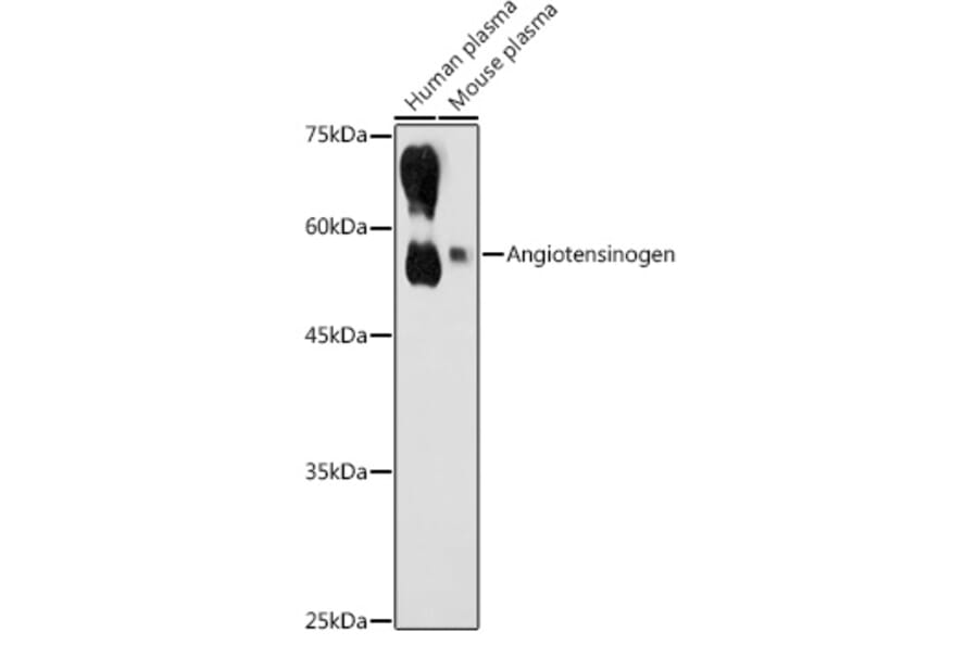 Western Blot - Anti-Angiotensinogen Antibody (A90383) - Antibodies.com