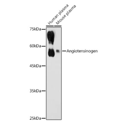 Western Blot - Anti-Angiotensinogen Antibody (A90383) - Antibodies.com