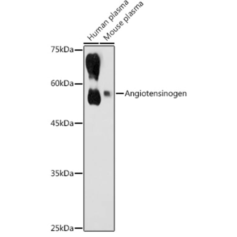 Western Blot - Anti-Angiotensinogen Antibody (A90383) - Antibodies.com