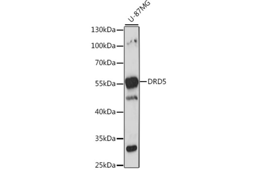 Western Blot - Anti-DRD5 Antibody (A15662) - Antibodies.com