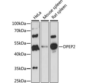 Western Blot - Anti-DPEP2 Antibody (A90385) - Antibodies.com