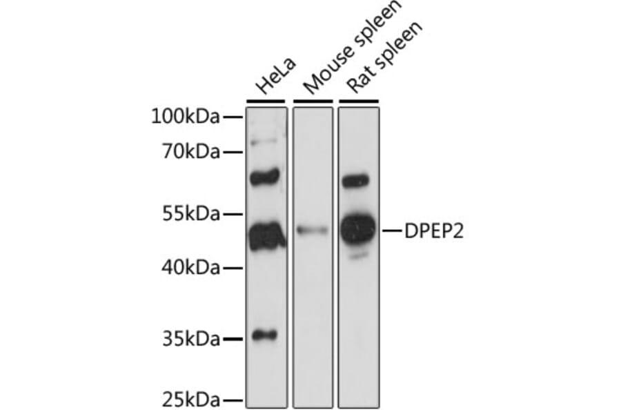 Western Blot - Anti-DPEP2 Antibody (A90385) - Antibodies.com