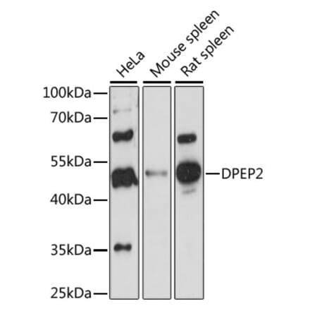 Western Blot - Anti-DPEP2 Antibody (A90385) - Antibodies.com