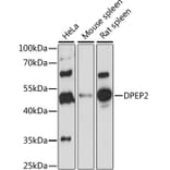 Western Blot - Anti-DPEP2 Antibody (A90385) - Antibodies.com