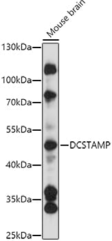 Western blot analysis of extracts of various cell lines, using Anti-DCSTAMP Antibody (A14630) at 1:1,000 dilution.
Secondary antibody: Goat Anti-Rabbit IgG (H+L) (HRP) (AS014) at 1:10,000 dilution.
Lysates / proteins: 25µg per lane.
Blocking buffer: 3% non-fat dry milk in TBST.
Detection: ECL Basic Kit (RM00020).
Exposure time: 90s.