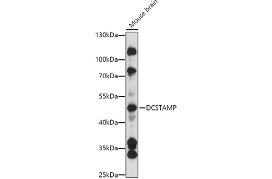 Western Blot - Anti-DCSTAMP Antibody (A90386) - Antibodies.com