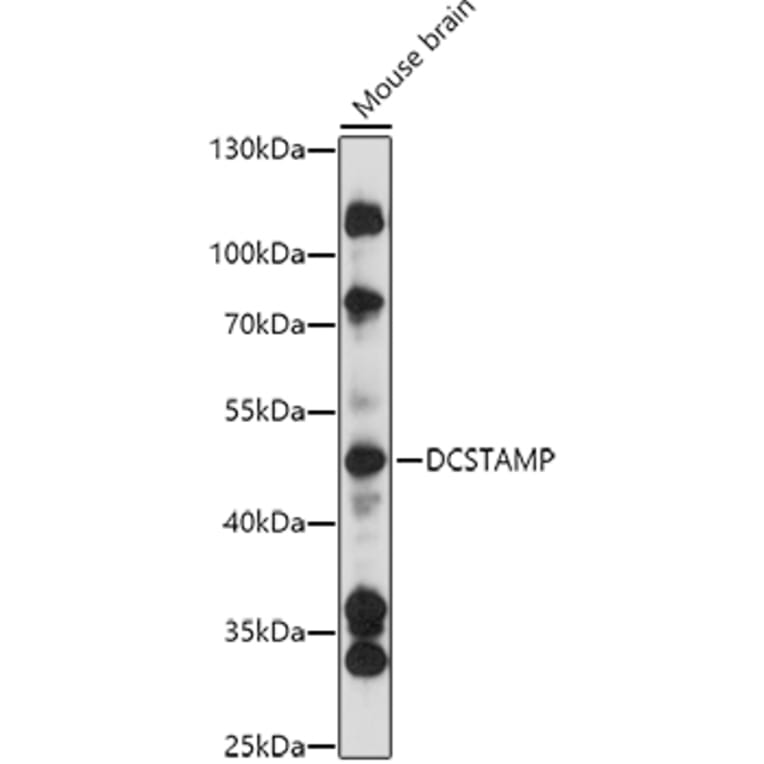 Western Blot - Anti-DCSTAMP Antibody (A90386) - Antibodies.com