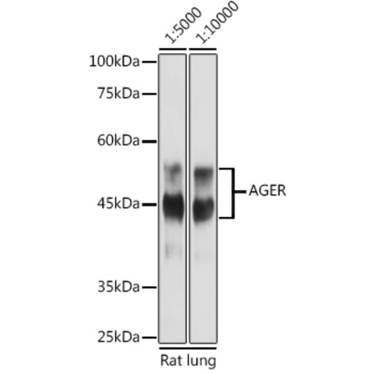 Western Blot - Anti-RAGE Antibody (A90387) - Antibodies.com