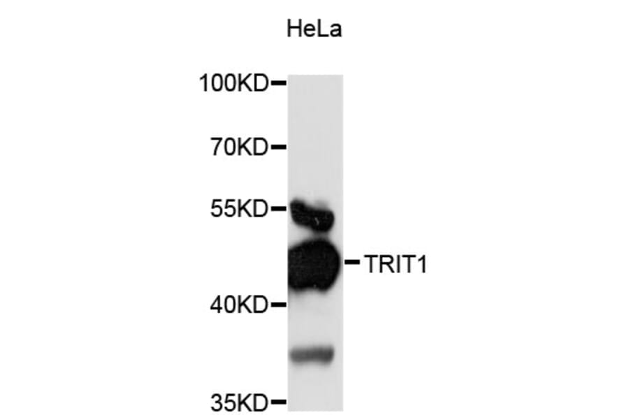 Western Blot - Anti-TRIT1 Antibody (A13100) - Antibodies.com