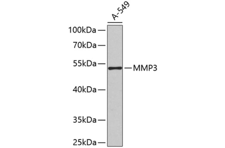 Western Blot - Anti-MMP3 Antibody (A2426) - Antibodies.com