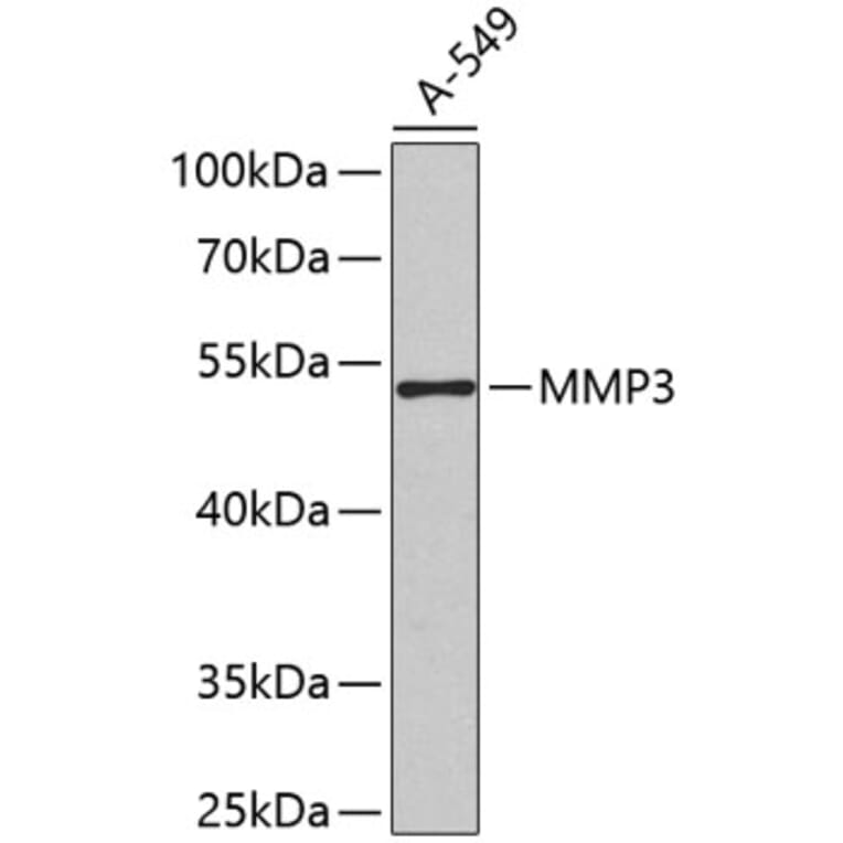 Western Blot - Anti-MMP3 Antibody (A2426) - Antibodies.com