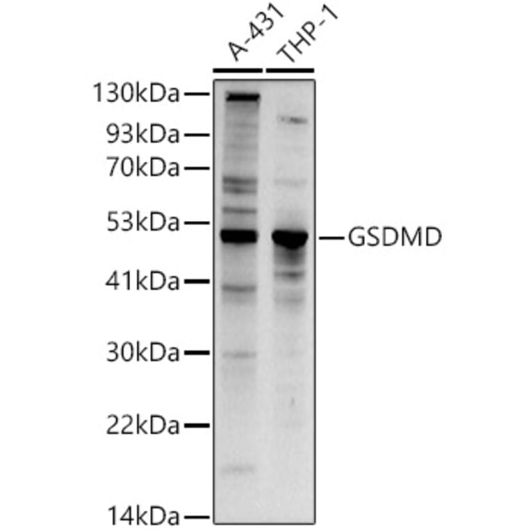 Western Blot - Anti-GSDMD (Full-length and C-terminal) Antibody (A90390) - Antibodies.com