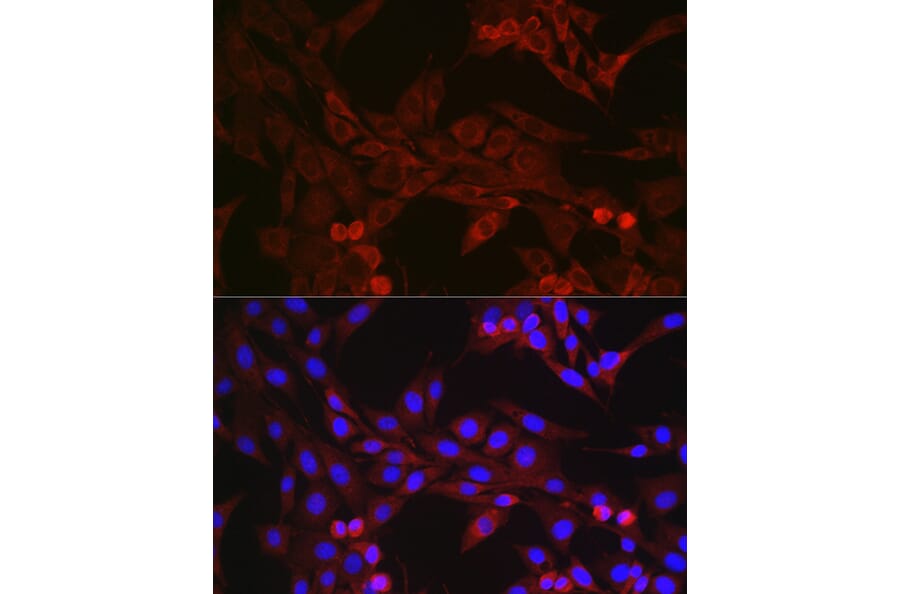 Immunofluorescence - Anti-GSDMD (Full-length and C-terminal) Antibody (A90390) - Antibodies.com