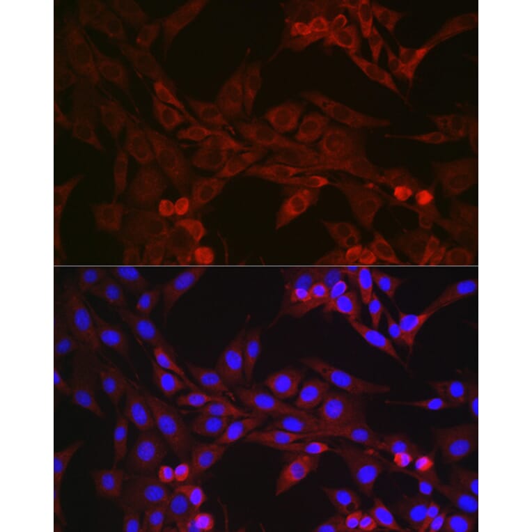 Immunofluorescence - Anti-GSDMD (Full-length and C-terminal) Antibody (A90390) - Antibodies.com