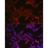 Immunofluorescence - Anti-GSDMD (Full-length and C-terminal) Antibody (A90390) - Antibodies.com