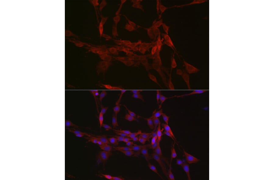 Immunofluorescence - Anti-GSDMD (Full-length and C-terminal) Antibody (A90390) - Antibodies.com