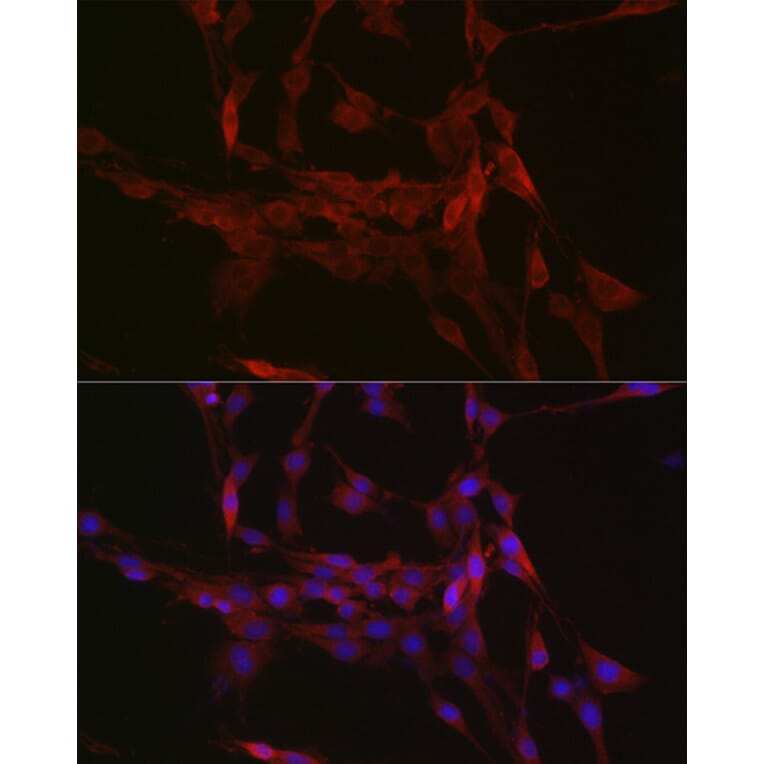 Immunofluorescence - Anti-GSDMD (Full-length and C-terminal) Antibody (A90390) - Antibodies.com