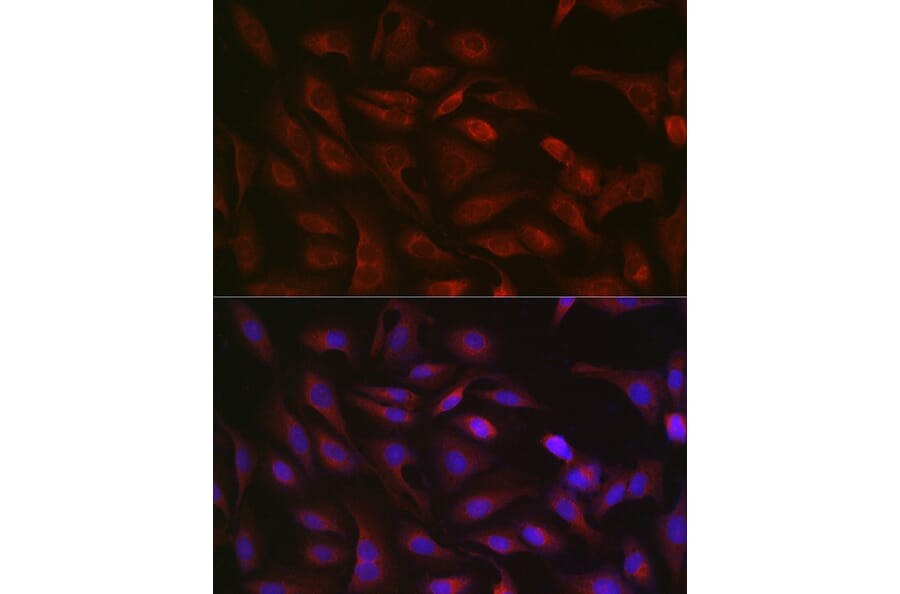 Immunofluorescence - Anti-GSDMD (Full-length and C-terminal) Antibody (A90390) - Antibodies.com