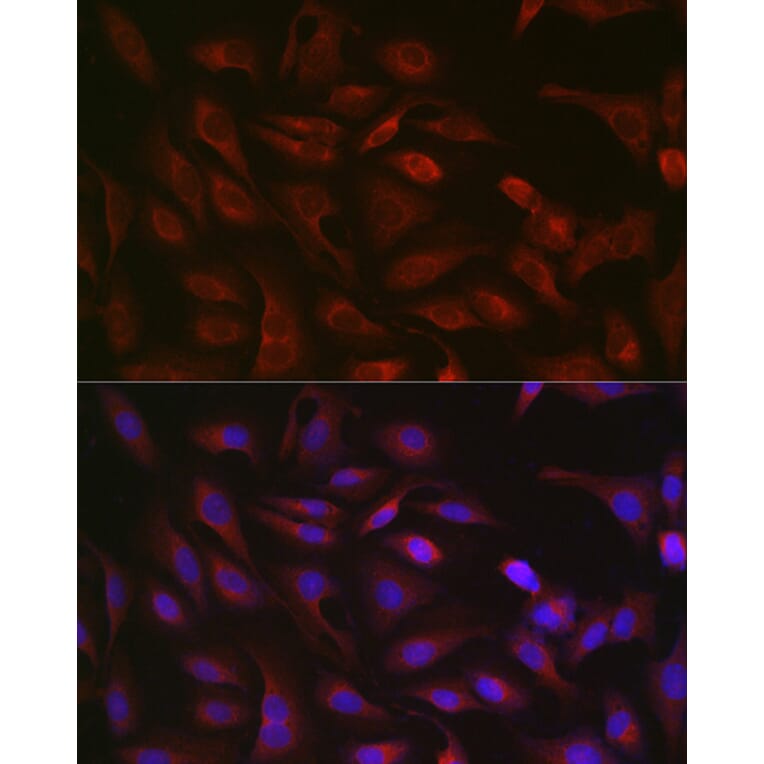 Immunofluorescence - Anti-GSDMD (Full-length and C-terminal) Antibody (A90390) - Antibodies.com