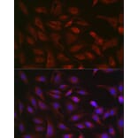 Immunofluorescence - Anti-GSDMD (Full-length and C-terminal) Antibody (A90390) - Antibodies.com