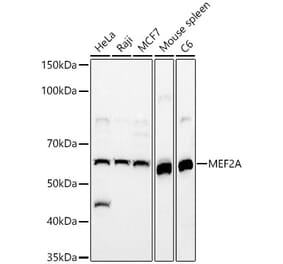 Western Blot - Anti-MEF2A Antibody (A90391) - Antibodies.com